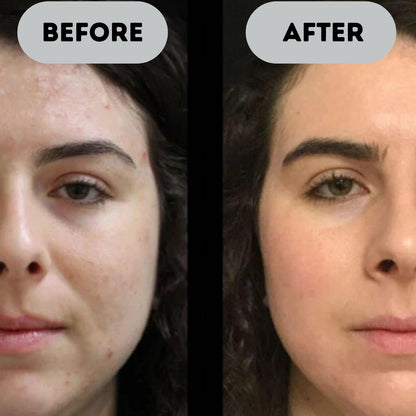 Braugo™ - Anti-Aging Booster Pro