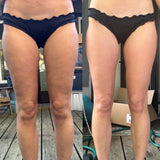Braugo™ - Anti-Cellulite Massager
